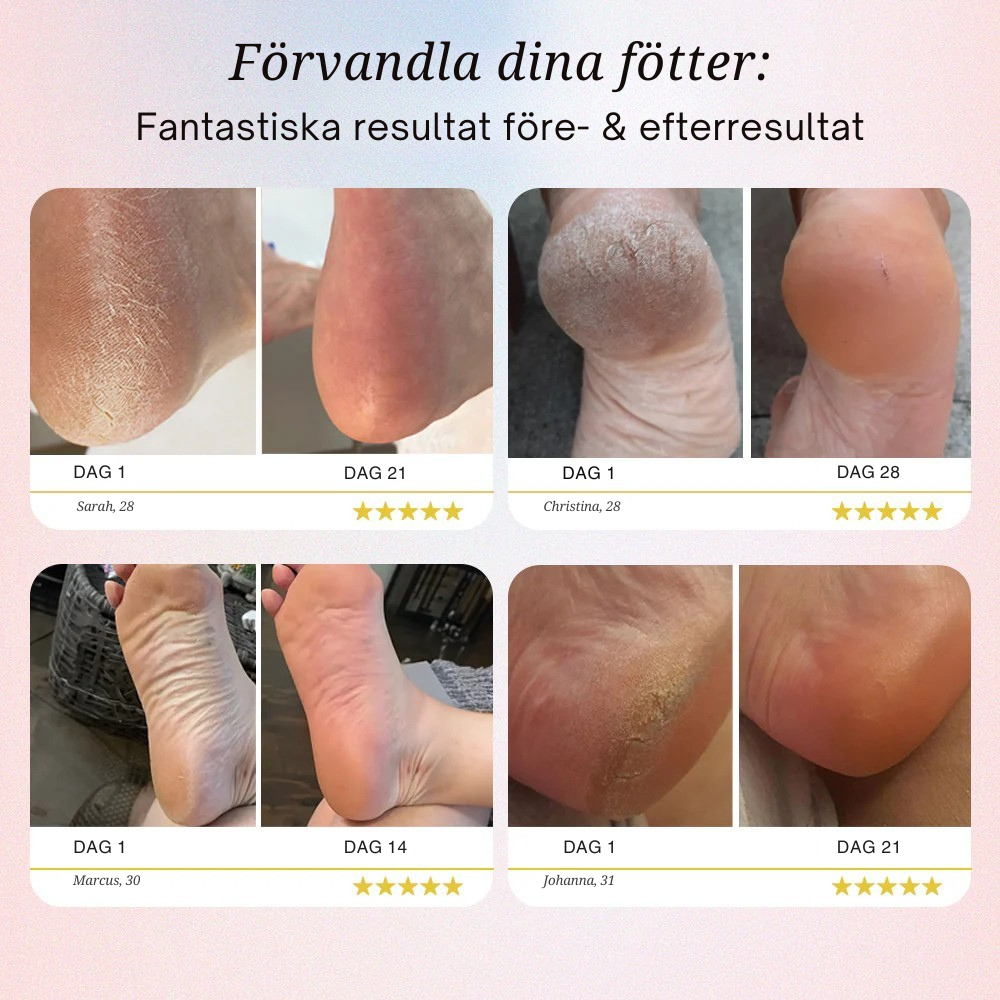 Lovi Pedi Pro 2 – Mjuka fötter utan dyra salongsbesök