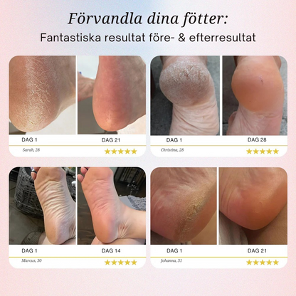 Lovi Pedi Pro 2 – Mjuka fötter utan dyra salongsbesök